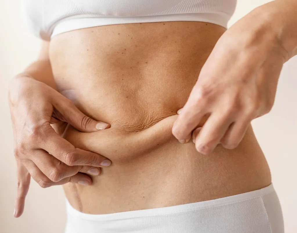 Autologous Fat Transfer