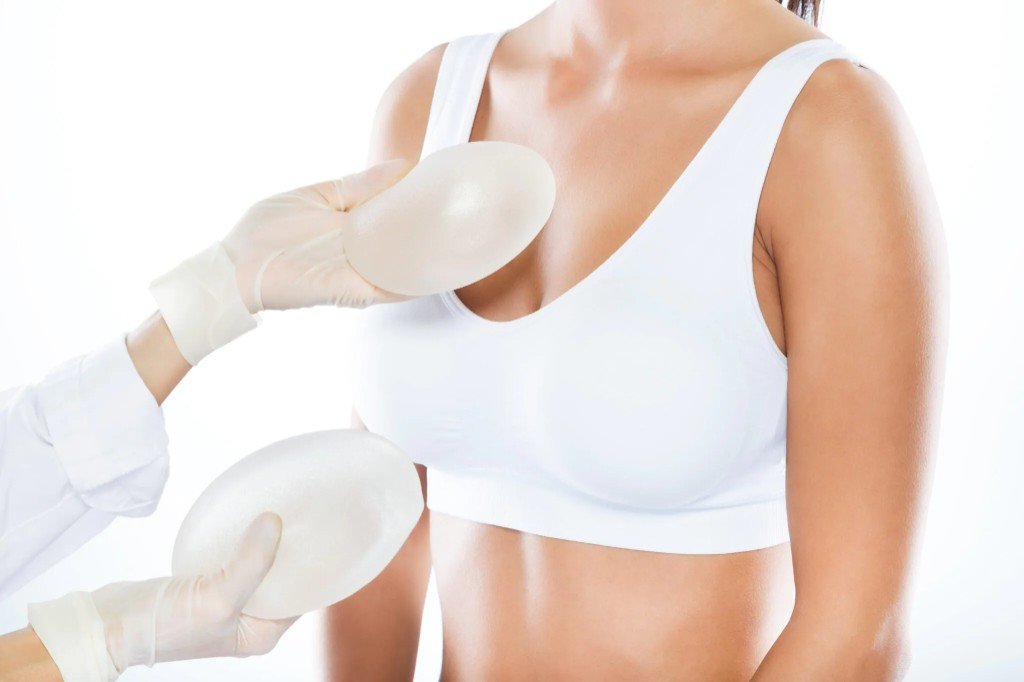 Mastopexy