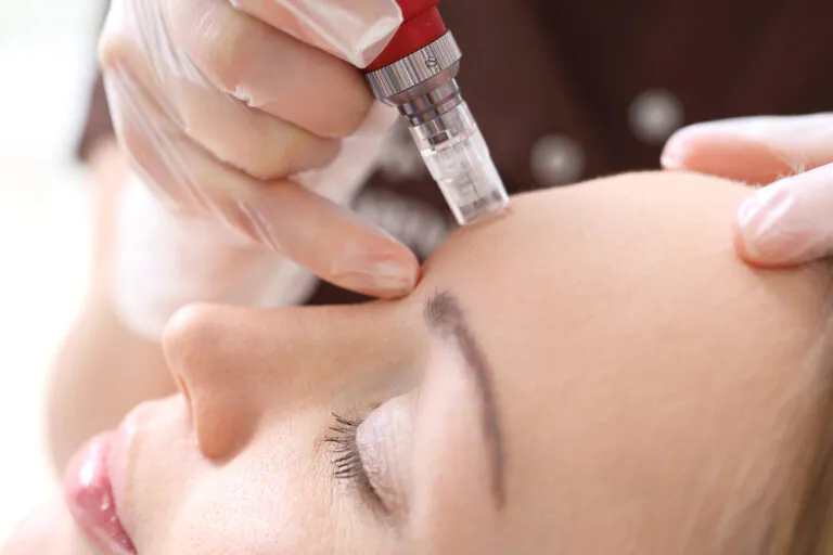 Mesotherapy meso-gun application