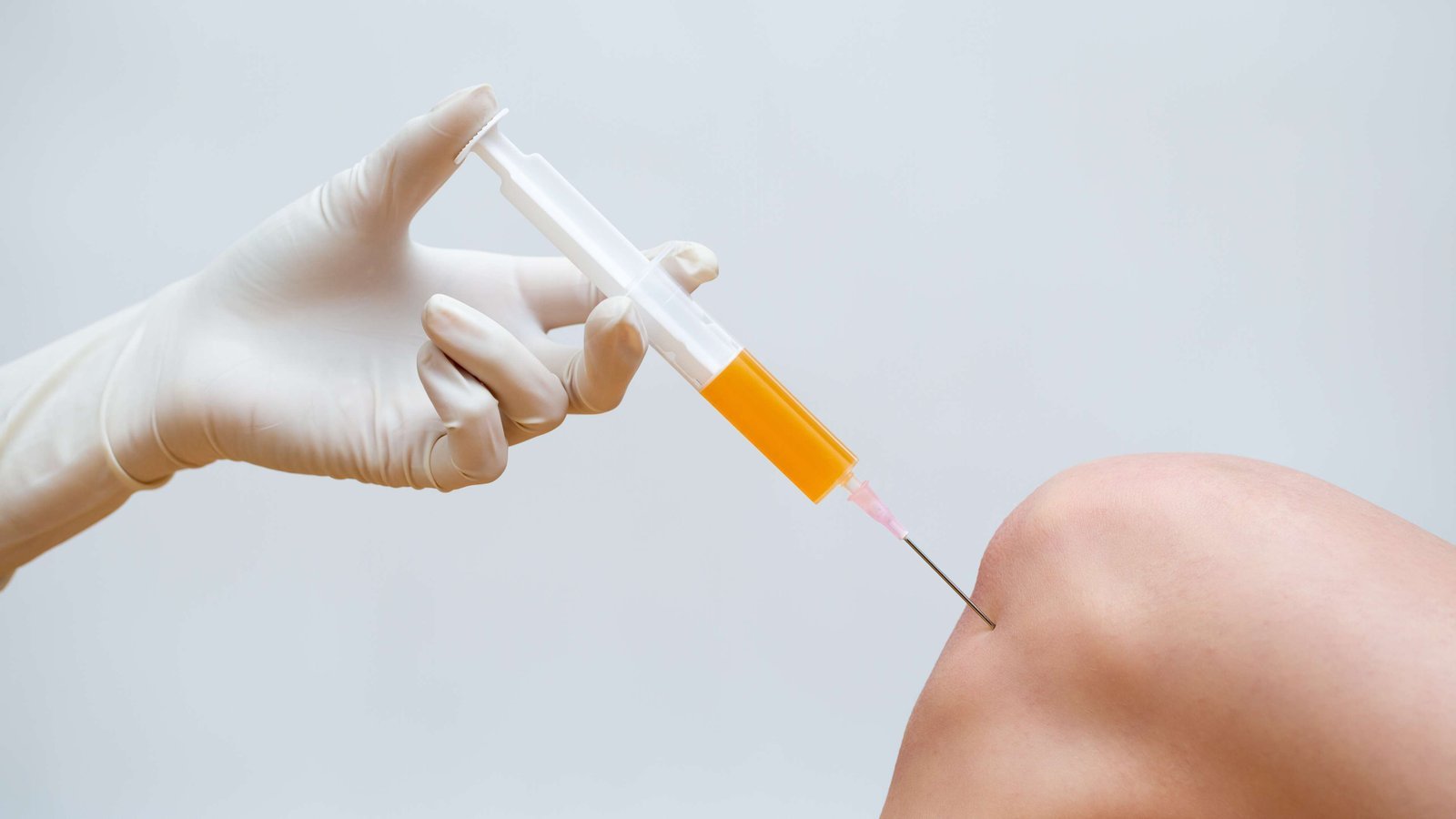 PRP Therapy